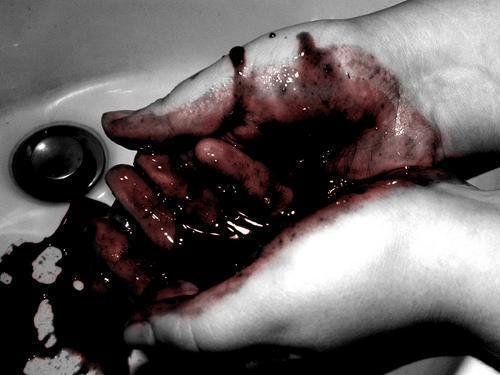 hands_with_blood.jpg